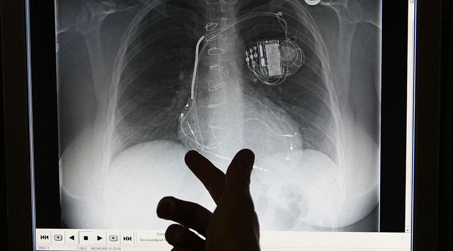 heart monitors
