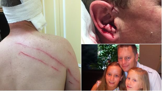 Matthew Chenhall's injuries and, below right, with his daughters Holly and Amelia. 