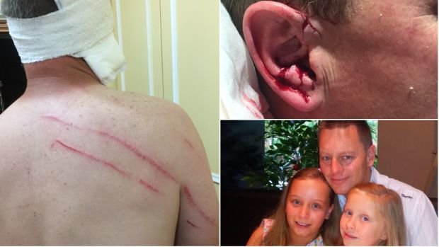 Click to enlarge Matthew Chenhall's injuries and, below right, with his daughters Holly and Amelia.