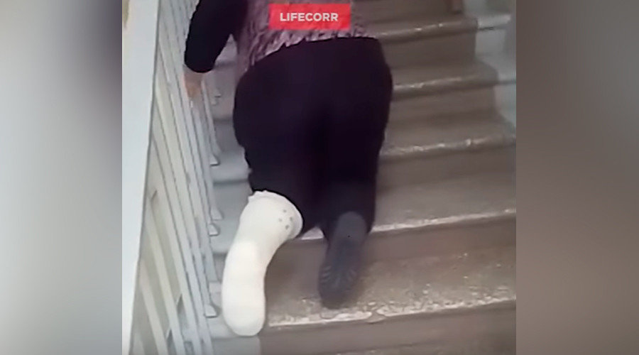 woman in leg cast climbs stairs
