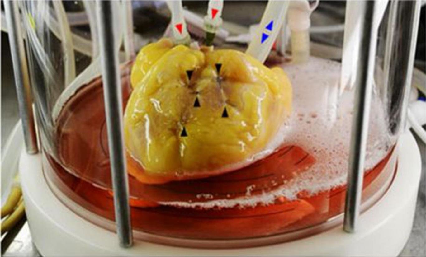 Click to enlarge heart from skin cells
