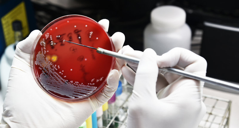 Drug resistant bacteria on petri dish