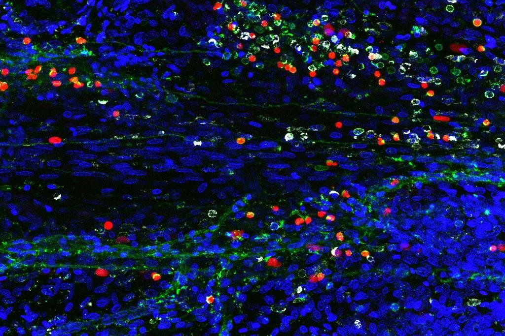 Type 2 innate lymphocytes