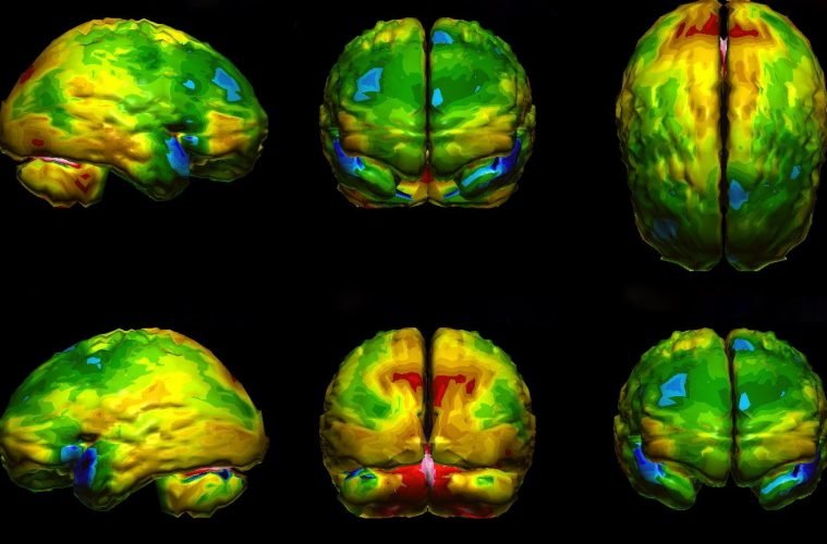 brain