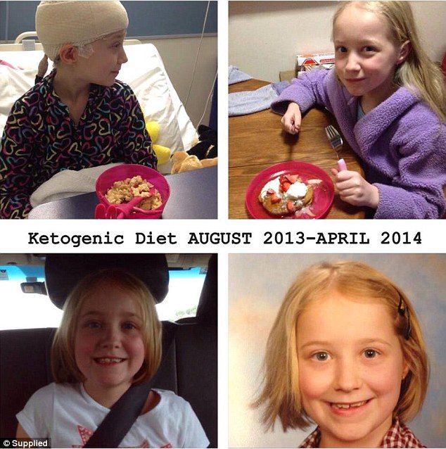 Click to enlarge keto diet epilepsy