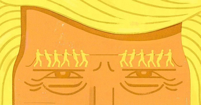 trump forehead conflict