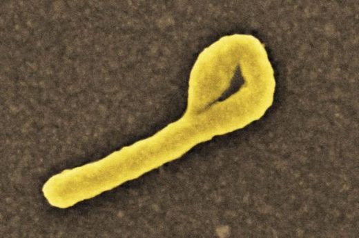 Click to enlarge Ebola virus