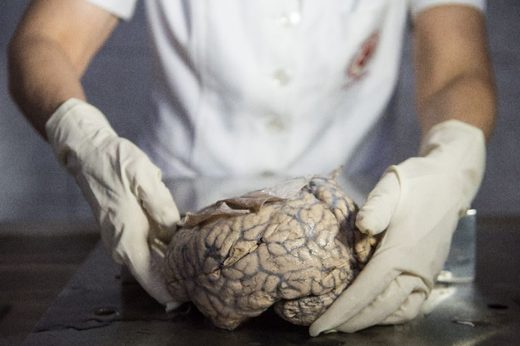 Click to enlarge Human brain