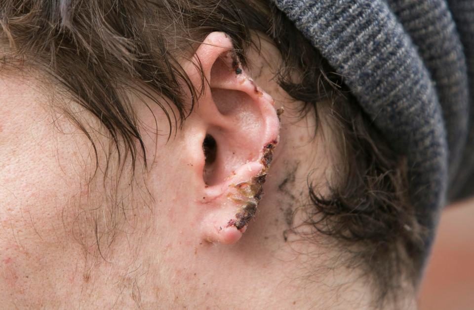 He was rushed to hospital after screaming in agony as the fox ate parts of his ear