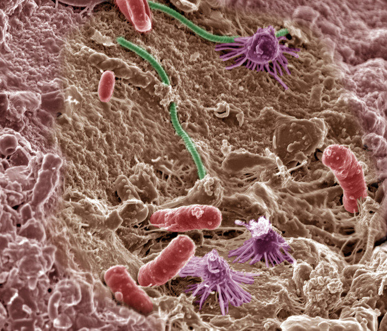 Click to enlarge Microbes in soil