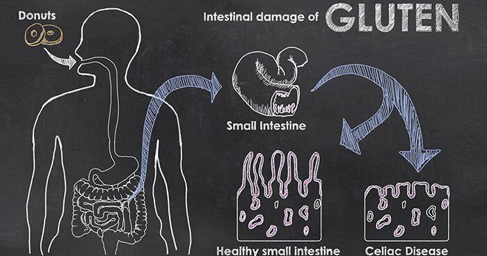 autoimmune disease