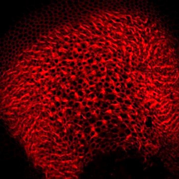 hair cells inner ear