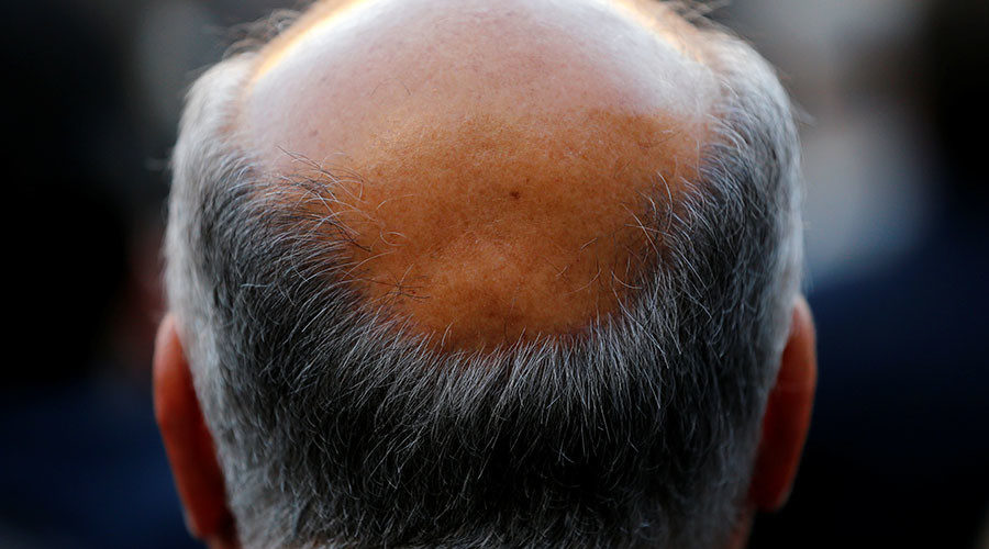 Bald head