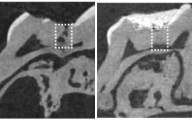 Click to enlarge tooth xray