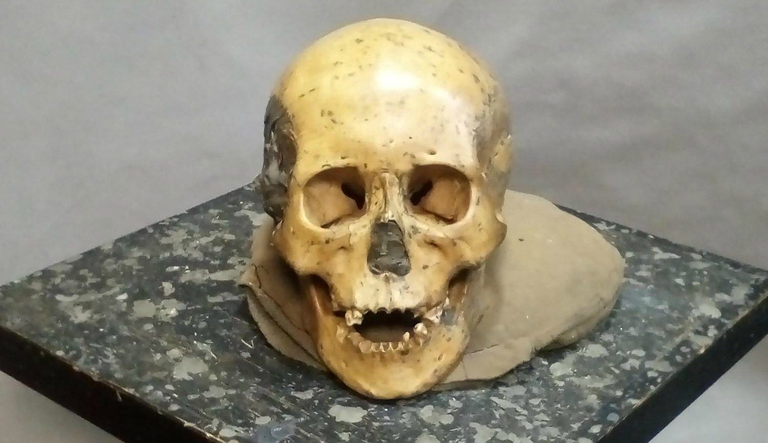 Click to enlarge Skull of Ancient Woman