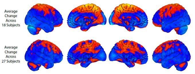 Click to enlarge brain changes