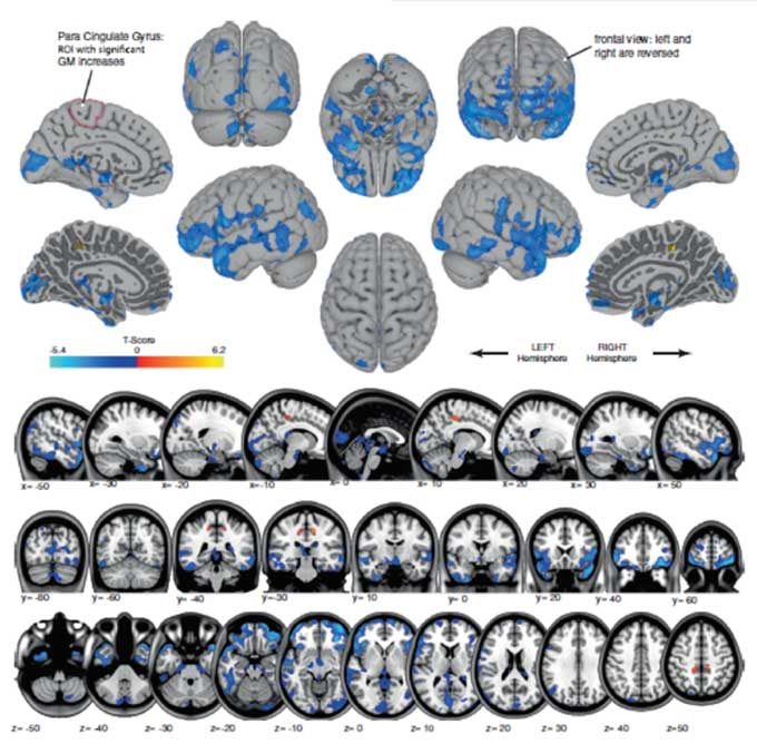 Click to enlarge brain studies