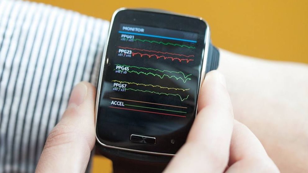 AI wrist device
