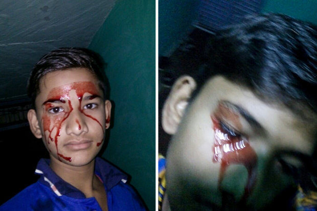 Indian child stigmata