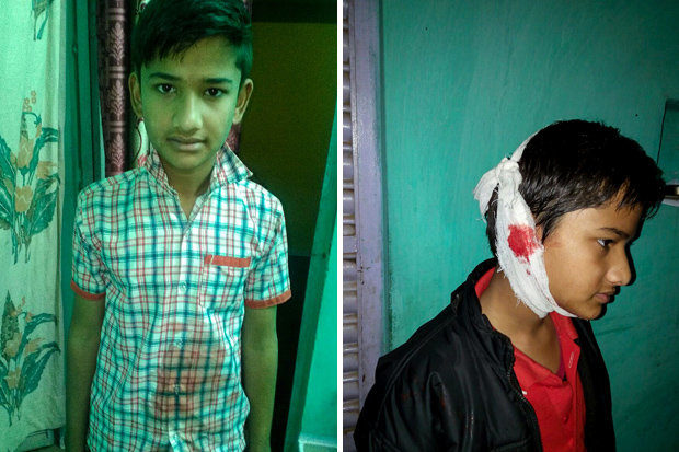 indian child stigmata, Akhilesh Raghuvanshi