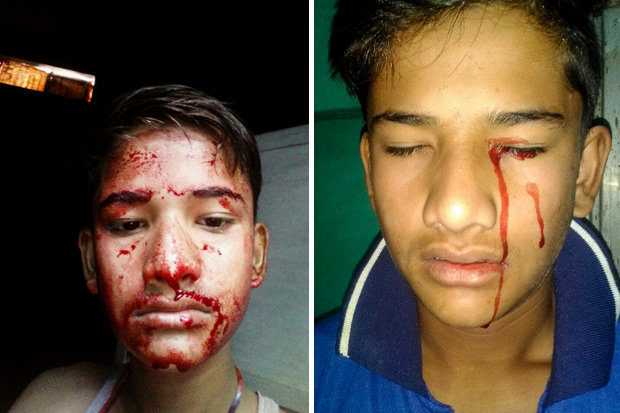 Akhilesh Raghuvanshi, indian child stigmata