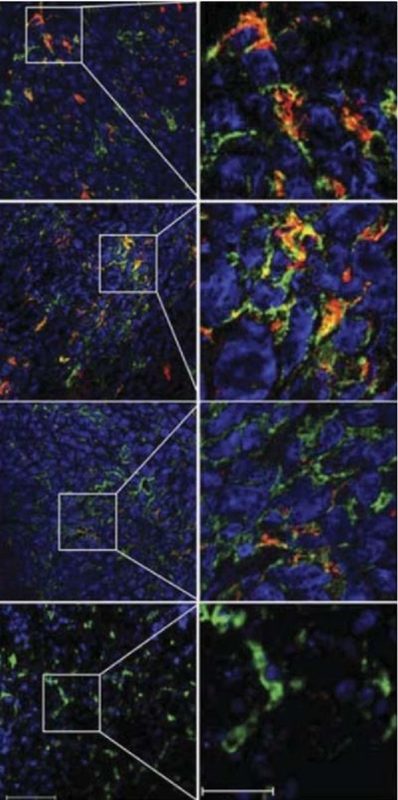 Click to enlarge immune cells