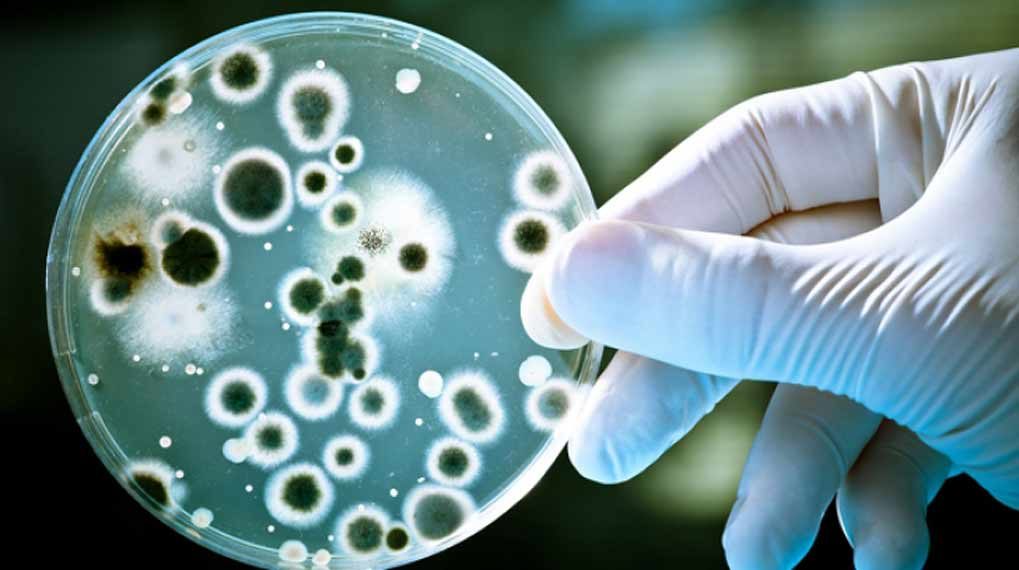 candida yeast fungus fungal culture