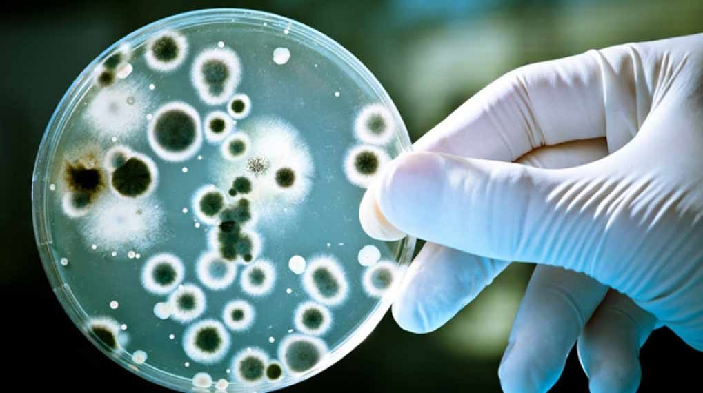 Click to enlarge candida yeast fungus fungal culture