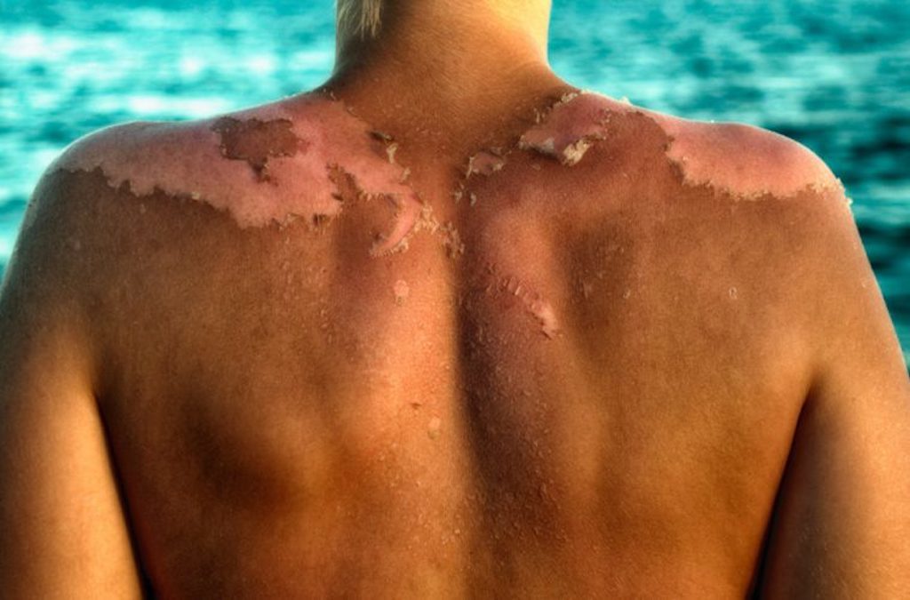 Click to enlarge toxic sunscreen