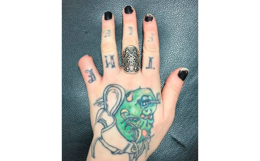 Click to enlarge Torz Reynolds hand little finger cut