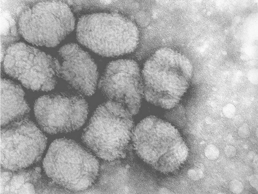 Click to enlarge Smallpox viruses