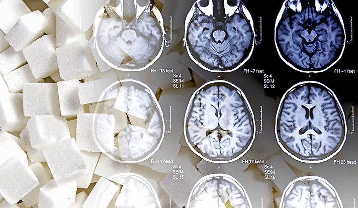 Fructose in the Brain