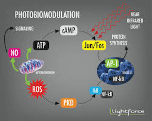 photobiomodulation