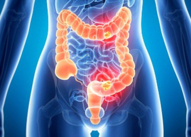 Click to enlarge Millenials digestive diseases