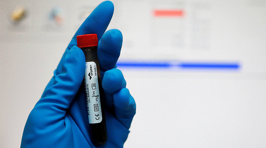 blood sample