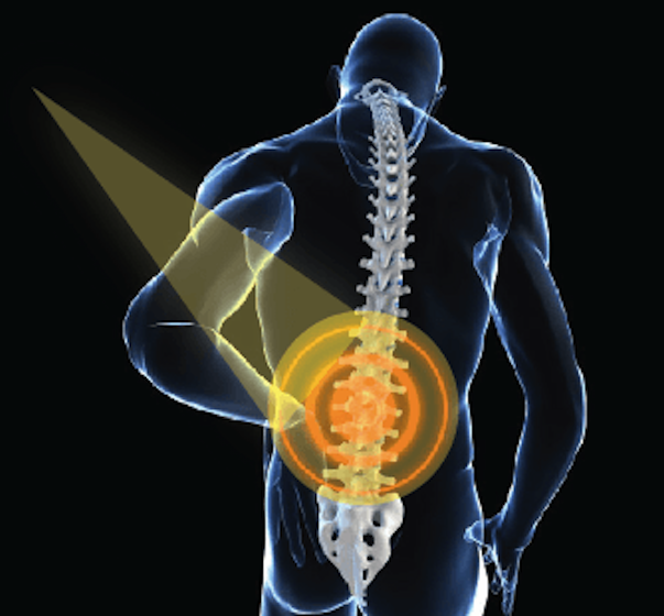 light therapy, chronic pain