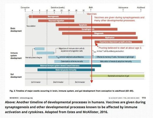 autism brain development