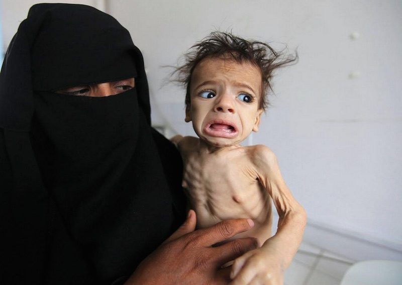 Famine in Yemen
