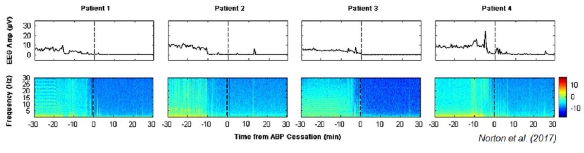 EEG Recordings