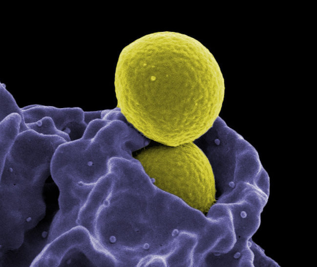 Click to enlarge bacteria