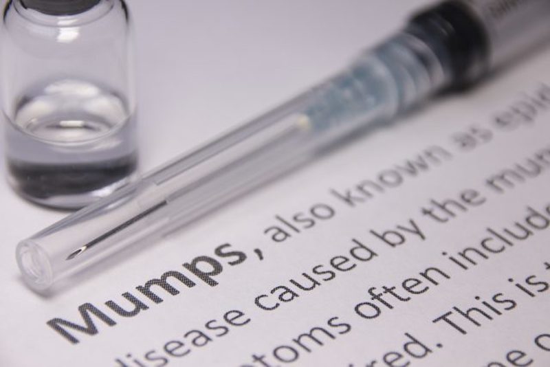 mumps