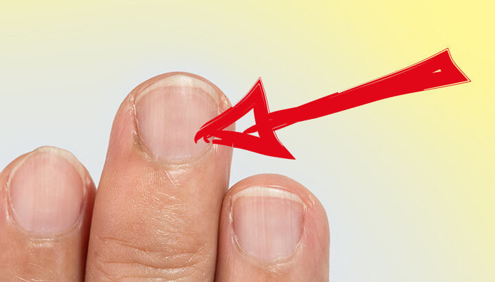 Click to enlarge fingernails