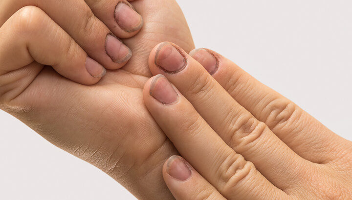 Click to enlarge fingernails