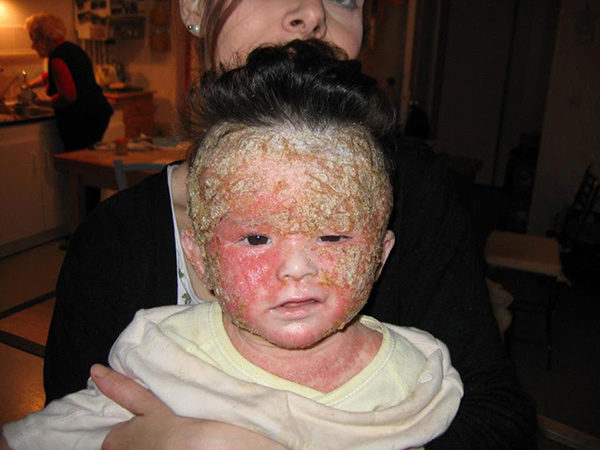 vaxxed
