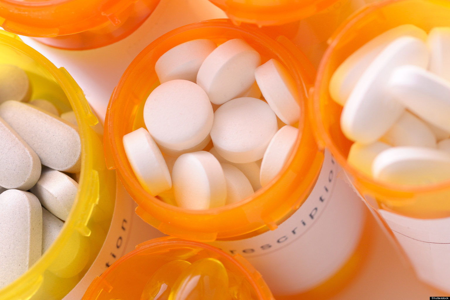 statins diabetes risk