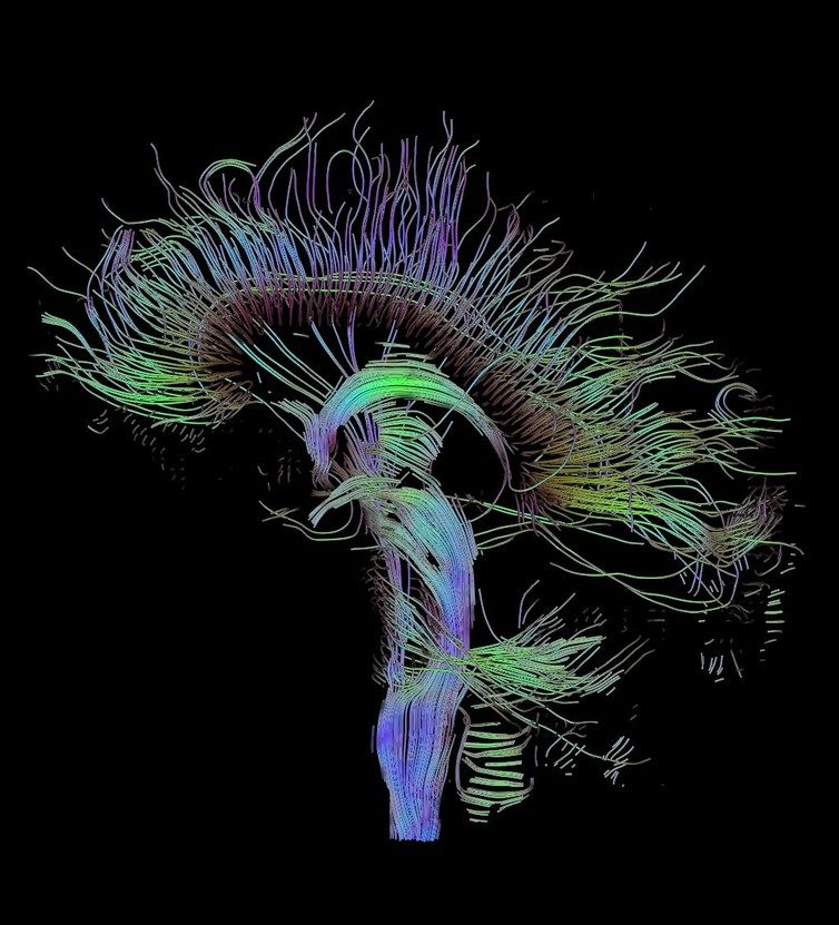 map neural connections brain