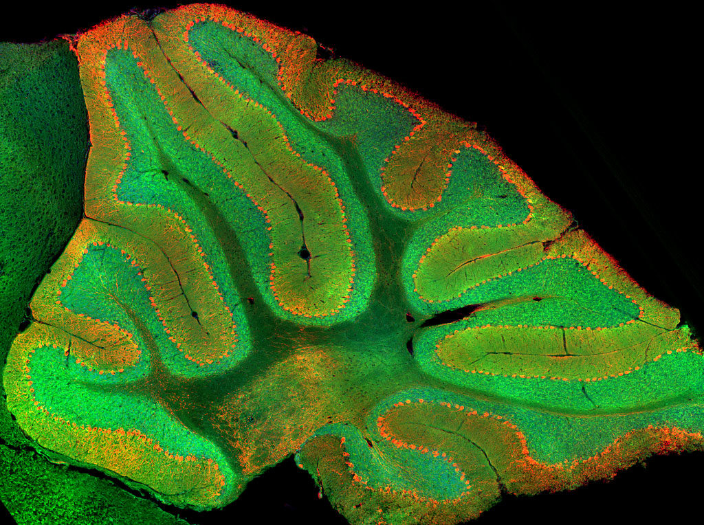 Click to enlarge cerebellum’s granule cells