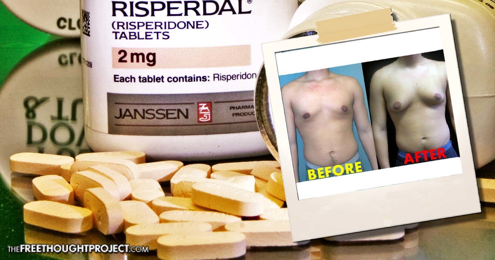 Risperdal gynecomastia
