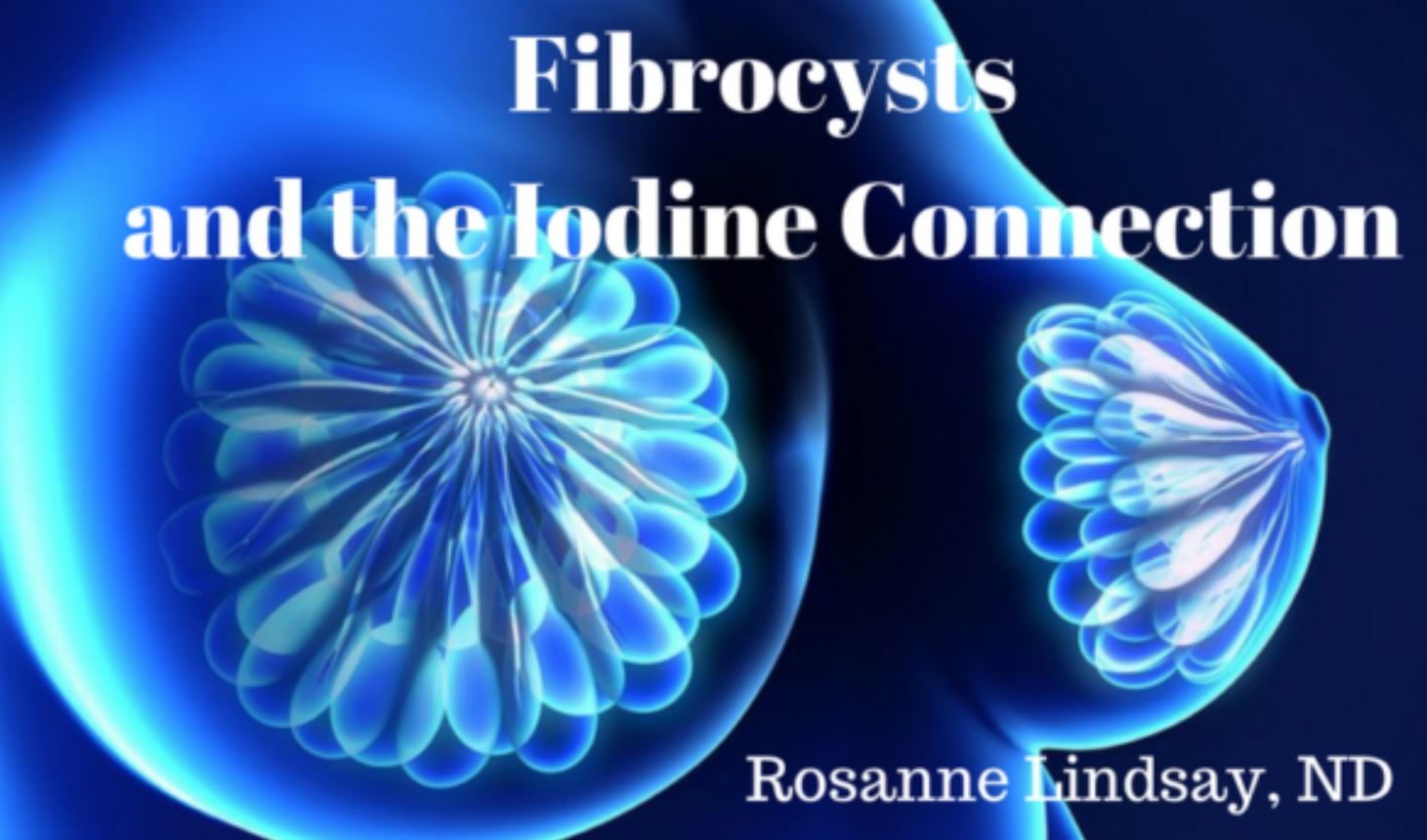 fibrocysts iodine
