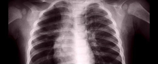 lungs